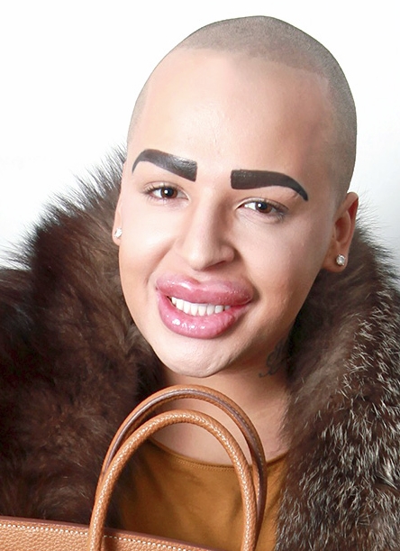 Man drops $150K to look like Kim Kardashian – with some serious duck
lips